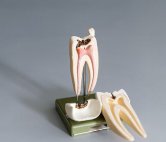 The Endodontic Renaissance: The Trifecta of Technology Enhancing Root Canals